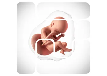 Fetal Alcohol Syndrome (FAS)