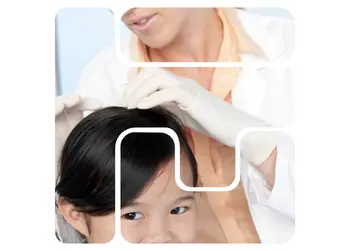 Head Lice